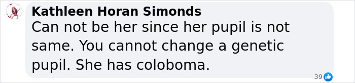 Comment discussing a woman's pupil and coloboma in relation to Madeleine McCann.