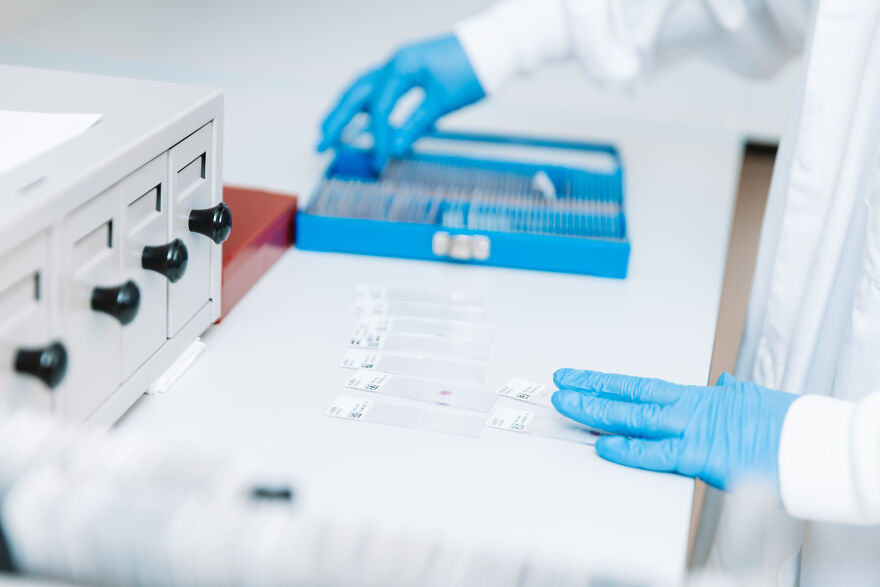 Scientist wearing blue gloves preparing microscope slides in a lab, related to Alzheimer&rsquo;s research and pharmaceuticals.