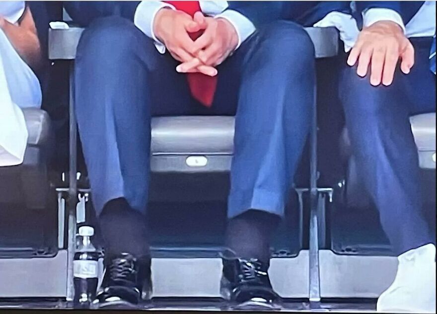 Close-up of legs and hands showing bizarre marks on Trump&rsquo;s body as experts reveal possible explanations during an event.