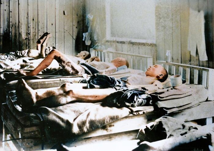 Survivors of Hiroshima and Nagasaki lying in hospital beds, illustrating aftermath lessons to avoid World War III.