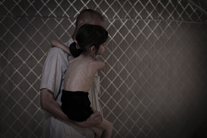 Man holding a severely malnourished child against a patterned background highlighting recognition of Palestine by major countries