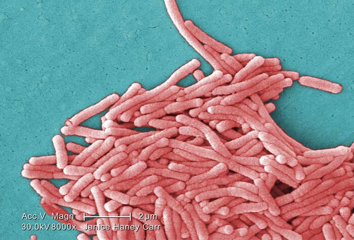 Legionella bacteria under a microscope causing Legionnaires&rsquo; disease outbreak sickening dozens in New York City.