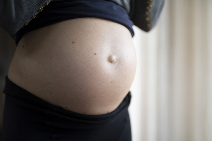 Here&rsquo;s What Experts Say About Trump&rsquo;s Claim That Autism Is Linked To Tylenol