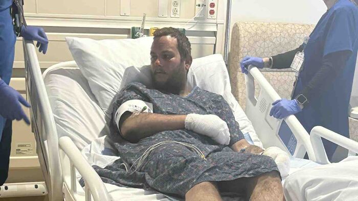 Man with bandaged hands lying in hospital bed after house fire injures parents and grandma, 4-year-old child involved