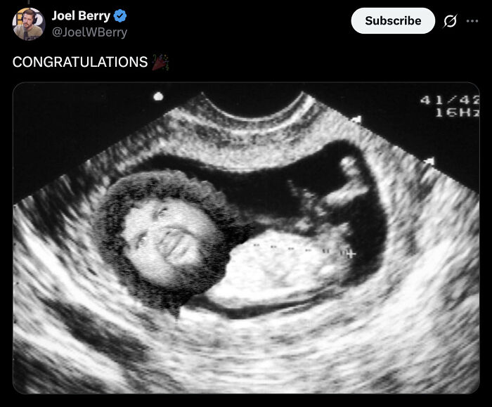 Ultrasound image with a humorous edited face, celebrating Usha Vance's fourth pregnancy announcement online.